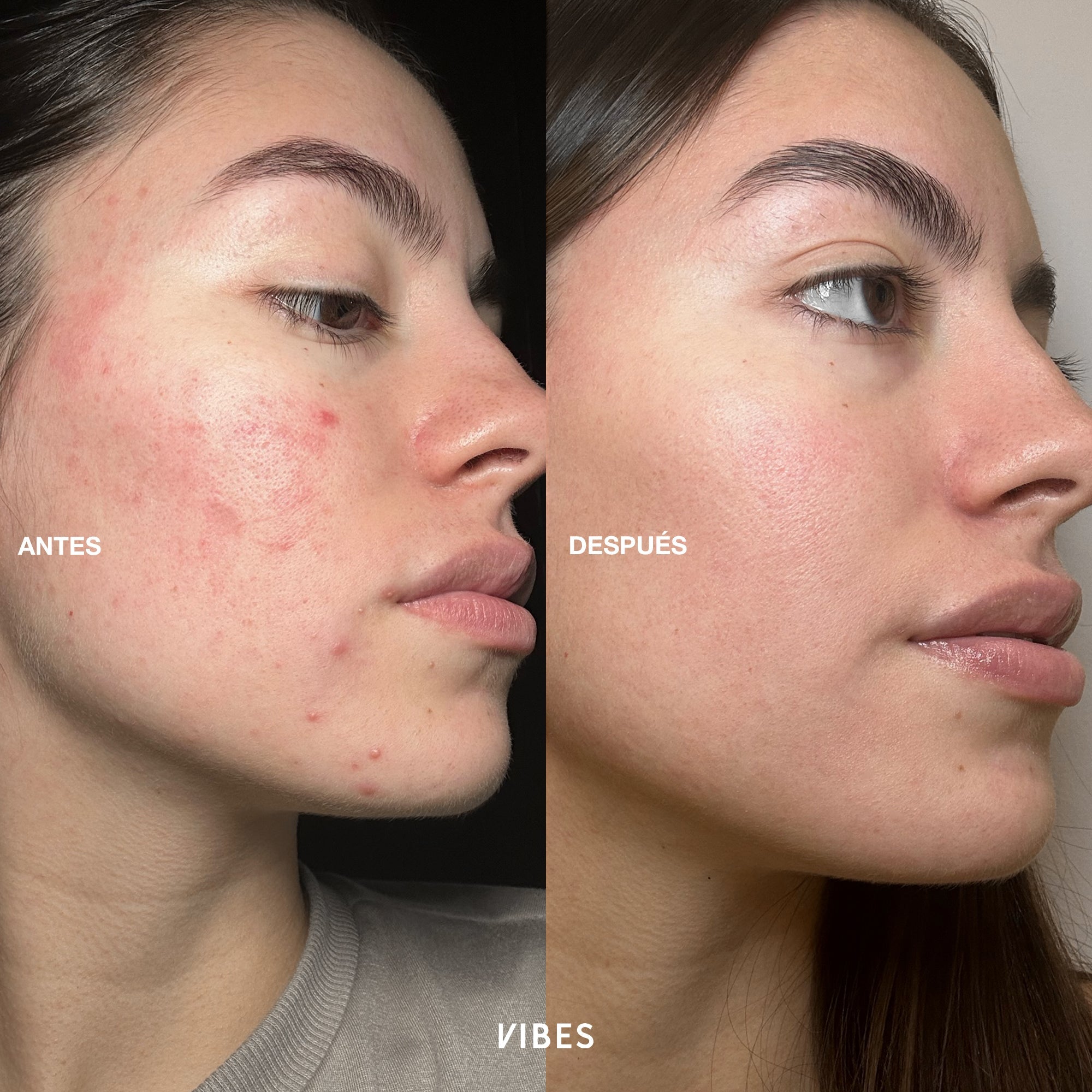 VIBES LIMPIADOR FACIAL CON ACIDO HIALURONICO 280 ML