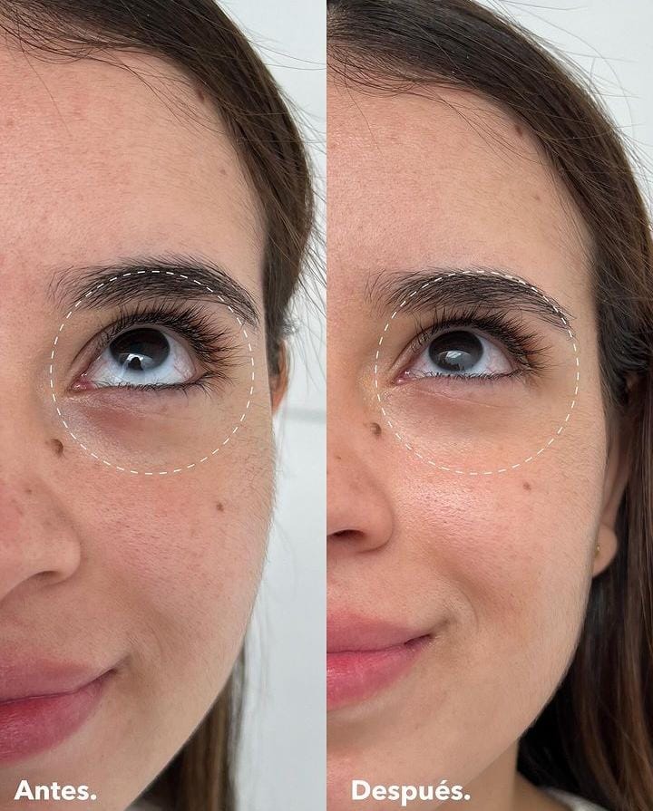 VIBES CONTORNO DE OJOS PARA BOLSAS Y OJERAS 10G