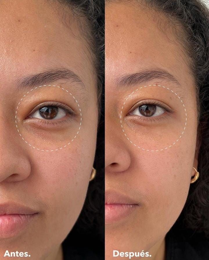 VIBES CONTORNO DE OJOS PARA BOLSAS Y OJERAS 10G