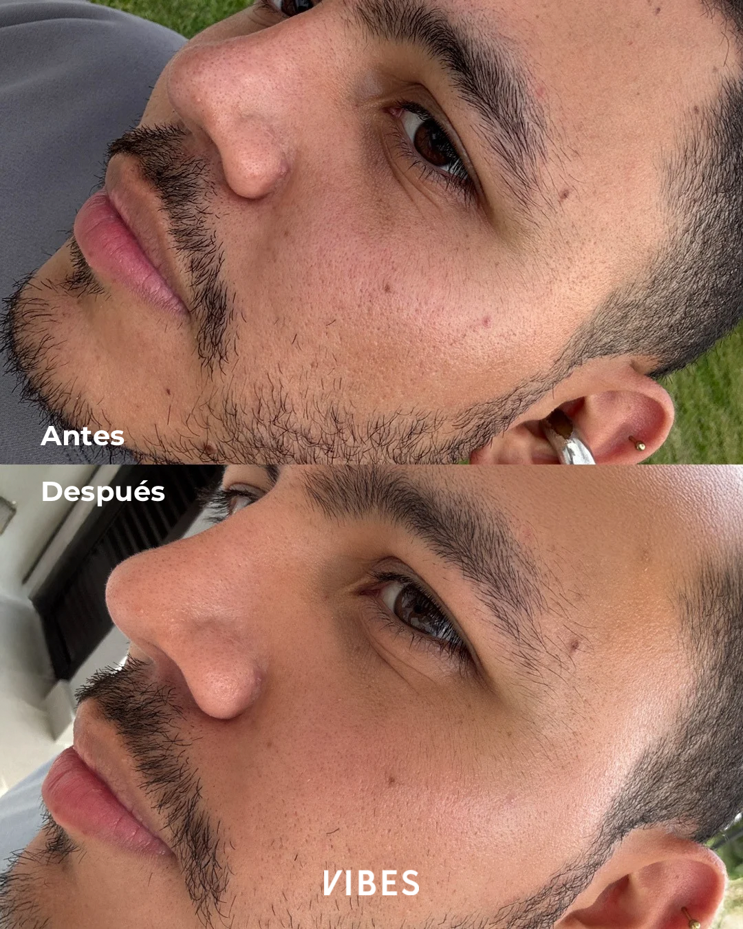 VIBES SERUM VITAMINA C DESPIGMENTANTE PARA MANCHAS Y TONO UNIFORME